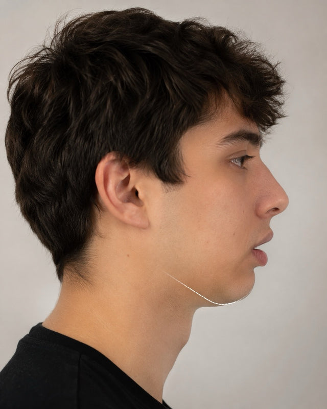 Bad Jawline and Facial Structure